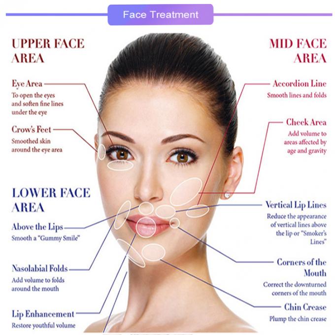 Piel no quirúrgica que rosca la cara del lifting facial que forma el hilo de Polydioxanone
