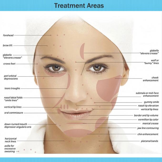 Rejuvenecimiento facial de las inyecciones cutáneas estéticas del llenador sin cirugía